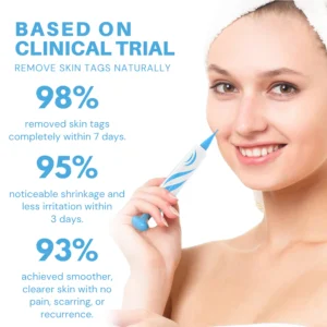 Fivfivgo® Painless At-home Skin Tag Removal Pen