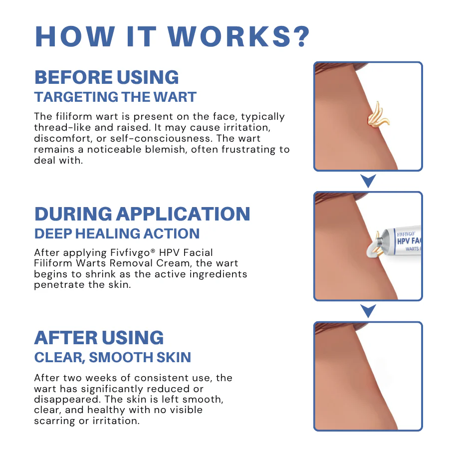 Fivfivgo® HPV Facial Filiform Warts Removal Cream 2 Fivfivgo® HPV Facial Filiform Warts Removal Cream