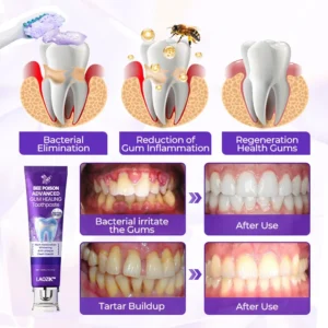 LAOZIK™ Bee Poison Advanced Gum Healing Toothpaste 9 LAOZIK™ Bee Poison Advanced Gum Healing Toothpaste