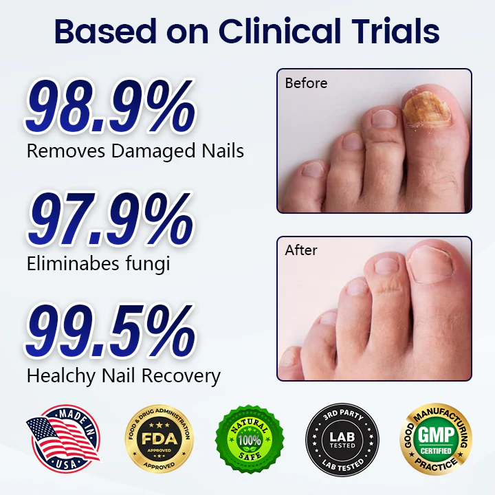 Timilk® Anti-Fungal Nail Repair Patch 2 Timilk® Anti-Fungal Nail Repair Patch