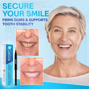 BQYOOM™ Gum Therapy Agent