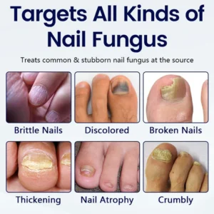 Timilk® Anti-Fungal Nail Repair Patch 9 Timilk® Anti-Fungal Nail Repair Patch