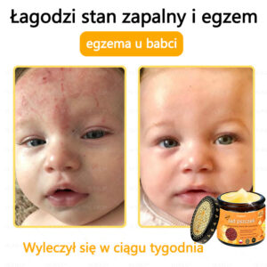 Foulme® Professional Bee Venom Removal Cream