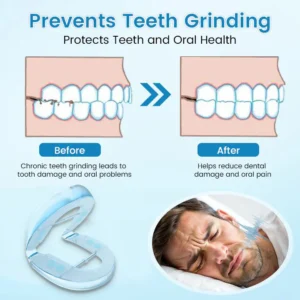 Bikenda® DreamGuard: Anti-Snoring & Teeth Grinding Teeth Protector