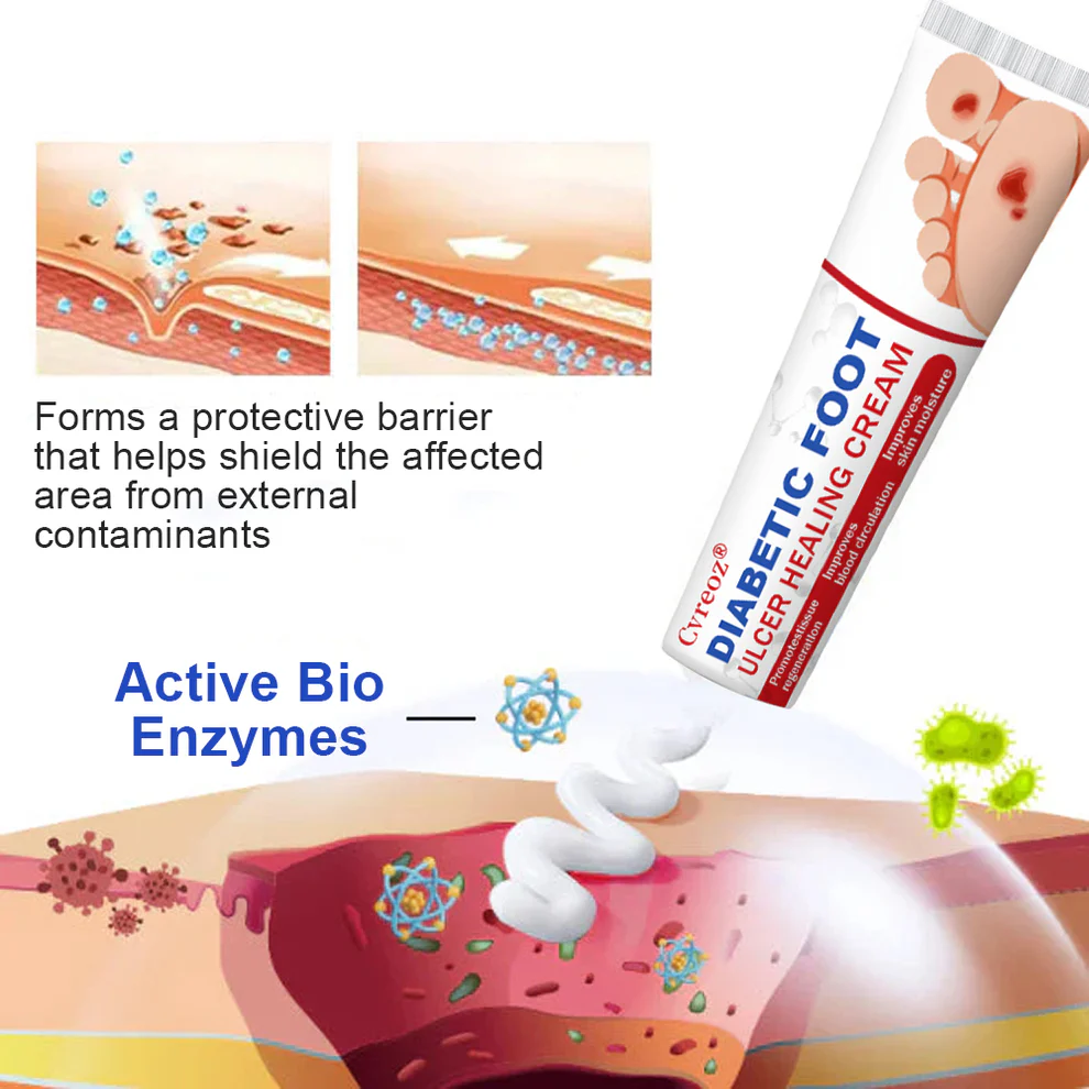 Cvreoz® Diabetic Foot Ulcer Healing Cream
