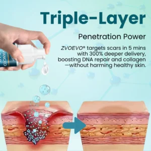 Zvoevo® Advanced Scar Gel for Surgical Scars image Zvoevo® Advanced Scar Gel for Surgical Scars