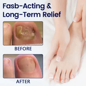 Timilk® Anti-Fungal Nail Repair Patch 7 Timilk® Anti-Fungal Nail Repair Patch