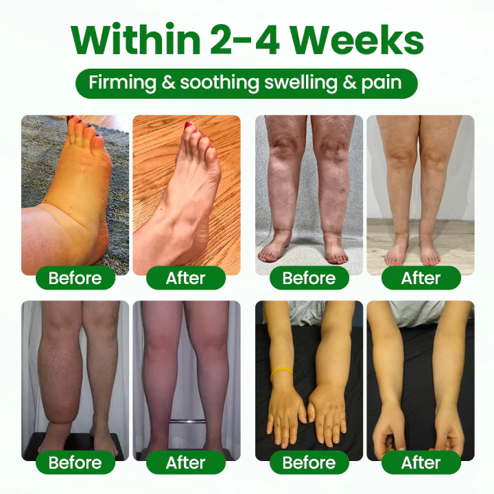 Timilk® VenoLift Leg Relief Spray 5 Timilk® VenoLift Leg Relief Spray