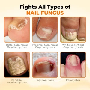 Timilk® NailRevive Bee Venom Anti-fungi Solution 9 Timilk® NailRevive Bee Venom Anti-fungi Solution