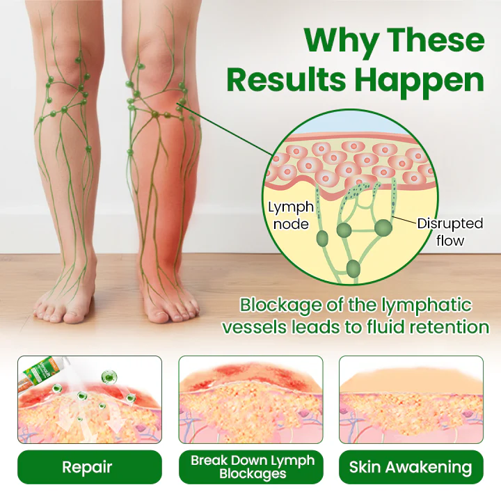 Timilk® VenoLift Leg Relief Spray 4 Timilk® VenoLift Leg Relief Spray