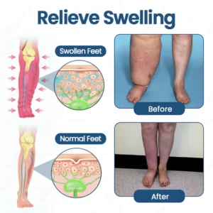 KUBOZN® Roll-On Pump Cream for Lymphatic Drainage & Swelling Relief