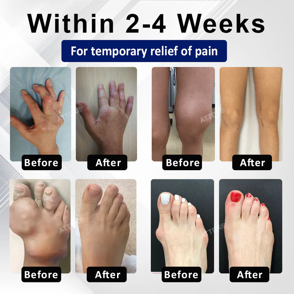 ATTDX® FlexiMag Joint Support Capsules