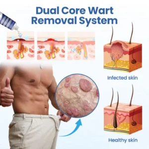 ATTDX® GentX WartRelief Cream