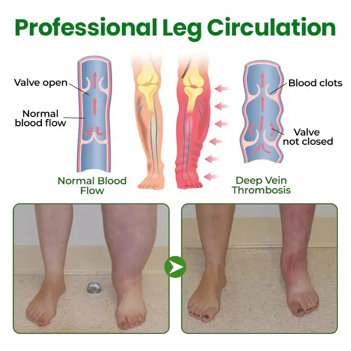 Cougex® VenoLift Leg Relief Spray 3 Cougex® VenoLift Leg Relief Spray