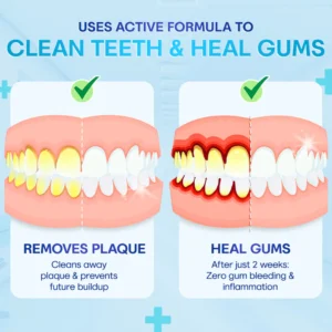 Negusy™ Gum Therapy Agent