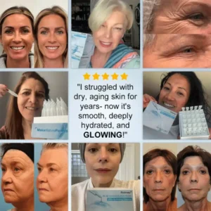 Rolimey® 3% 4D Hyaluronic Acid Serum Ampoules