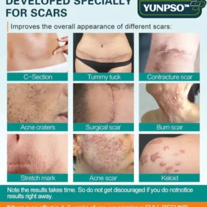 YUNPSO™ Advanced Scar Spray 7 YUNPSO™ Advanced Scar Spray