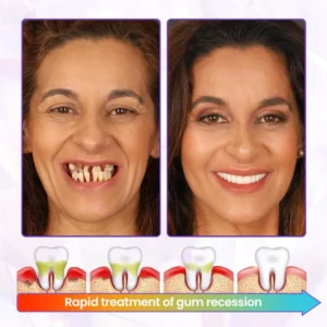 LAOZIK™ Bee Poison Advanced Gum Healing Toothpaste 6 LAOZIK™ Bee Poison Advanced Gum Healing Toothpaste