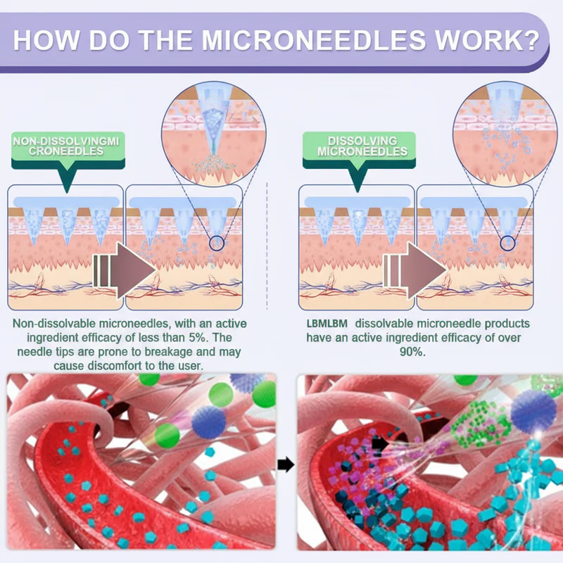 LBMLBM™ NIDDK-Tirzepatide Slimming & health NANO MICRONEEDLE PATCH 3 LBMLBM™ NIDDK-Tirzepatide Slimming & health NANO MICRONEEDLE PATCH
