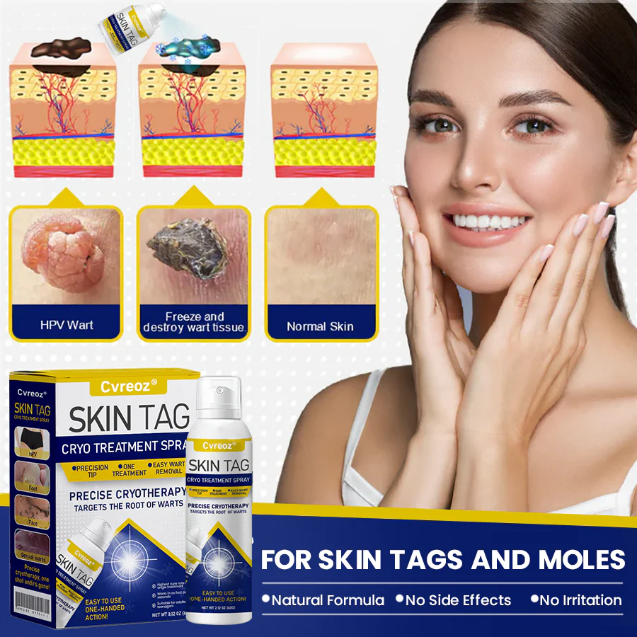 Cvreoz® Skin Tag Cryo Treatment Spray image Cvreoz® Skin Tag Cryo Treatment Spray