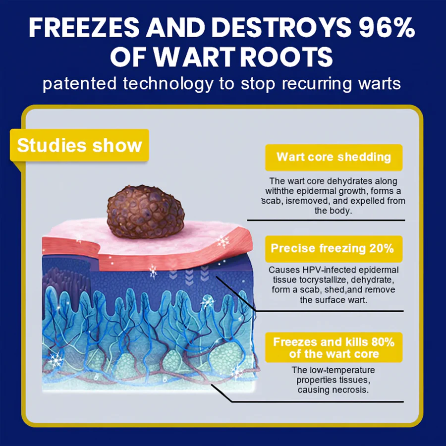 Cvreoz® Skin Tag Cryo Treatment Spray image Cvreoz® Skin Tag Cryo Treatment Spray