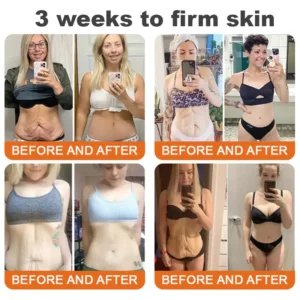 ODALIT™ Bee venom Comprehensive Cream