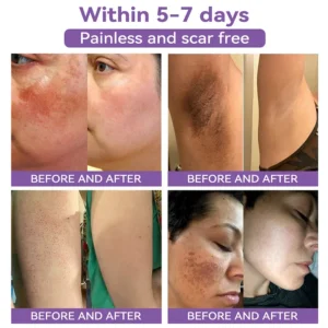 Bostore® hyaluronic acid nano micro-needle regenerating patch image Bostore® hyaluronic acid nano micro-needle regenerating patch