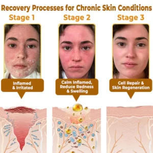 LOVILDS Bee Venom All-in-One Cream image LOVILDS Bee Venom All-in-One Cream