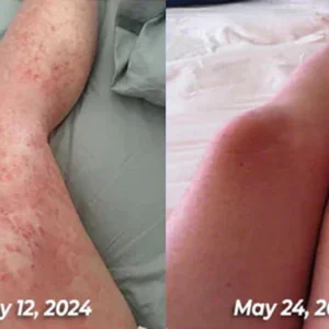 LOVILDS Bee Venom All-in-One Cream image LOVILDS Bee Venom All-in-One Cream