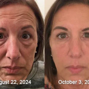 LOVILDS Bee Venom All-in-One Cream image LOVILDS Bee Venom All-in-One Cream