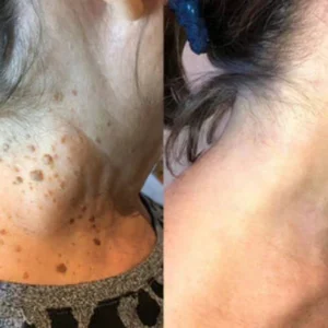 LOVILDS Bee Venom All-in-One Cream image LOVILDS Bee Venom All-in-One Cream