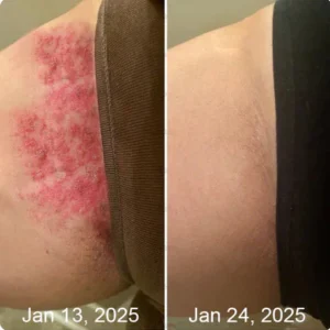 LOVILDS Bee Venom All-in-One Cream image LOVILDS Bee Venom All-in-One Cream