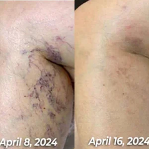 LOVILDS Bee Venom All-in-One Cream image LOVILDS Bee Venom All-in-One Cream