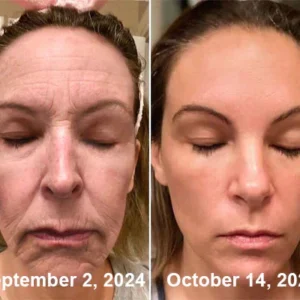 LOVILDS Bee Venom All-in-One Cream image LOVILDS Bee Venom All-in-One Cream