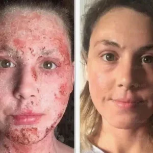 LOVILDS Bee Venom All-in-One Cream image LOVILDS Bee Venom All-in-One Cream