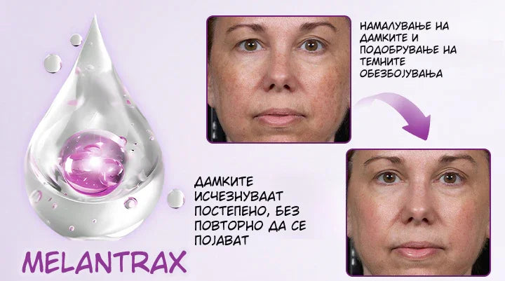 MelantraX – Advanced essence against pigmentation spots