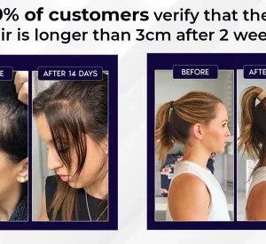 HZA™ Natural Hair Regrowth Spray