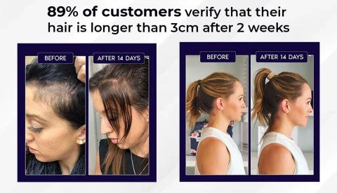 HZA™ Natural Hair Regrowth Spray