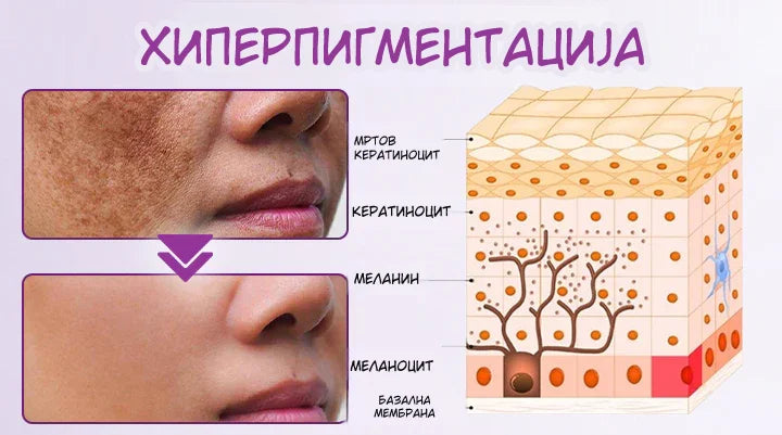 MelantraX – Advanced essence against pigmentation spots