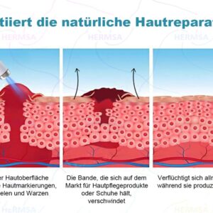 Hermsa® non-invasive laser pointer