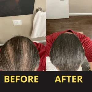 Slimoly™ Hair & Scalp Concealer 50ML