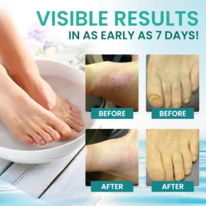 AEXZR® ItchBreak Sea Salt Soak image AEXZR® ItchBreak Sea Salt Soak