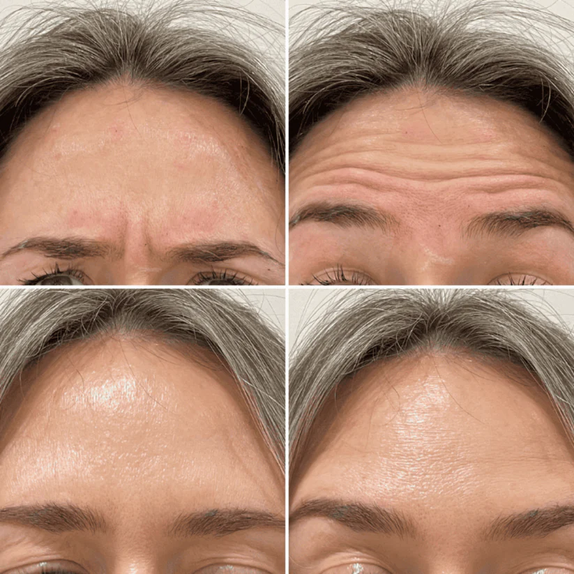 Lift, Tighten & Brighter - Celimax Retinal Glow boosting Cream