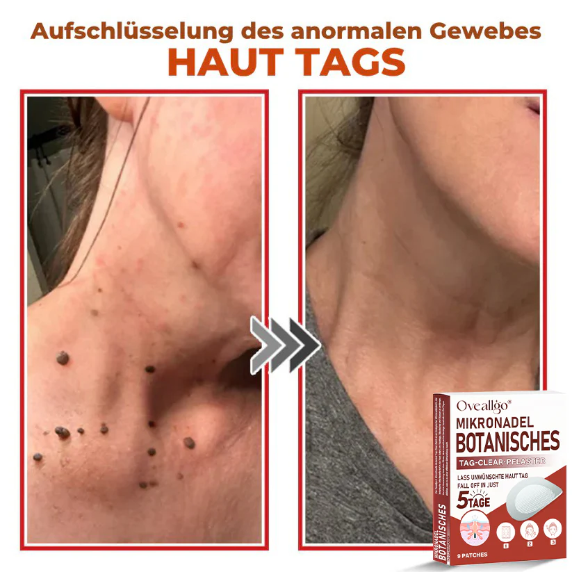 Oveallgo® MicroNeedle PLUS Botanical Day Clear Patch