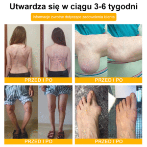 TLOPA® Botulinum Toxin and Bee Venom Pain Relief and Bone Healing Balm image TLOPA® Botulinum Toxin and Bee Venom Pain Relief and Bone Healing Balm