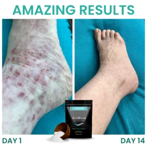 AEXZR® ItchBreak Sea Salt Soak image AEXZR® ItchBreak Sea Salt Soak