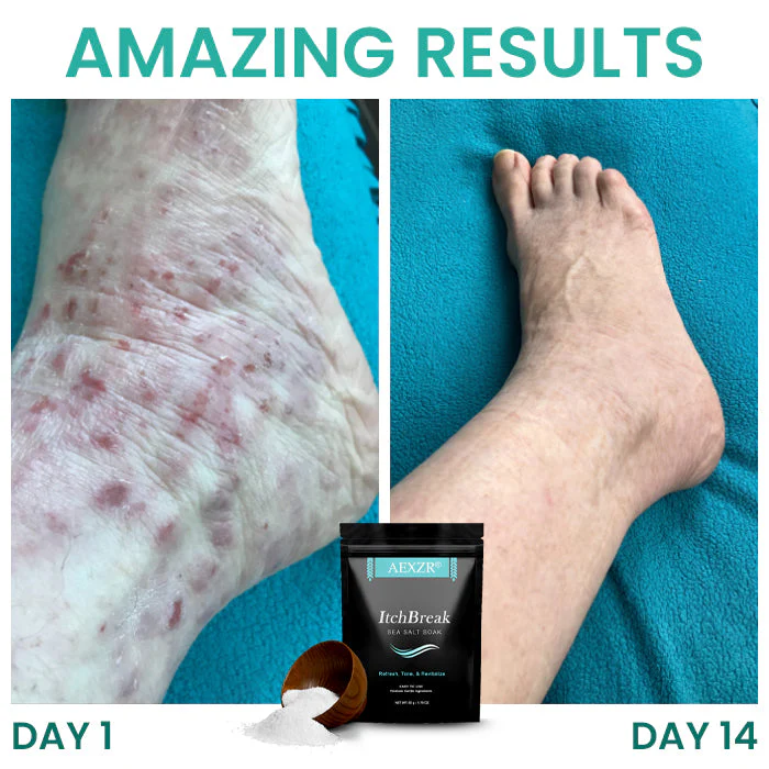 AEXZR® ItchBreak Sea Salt Soak image AEXZR® ItchBreak Sea Salt Soak