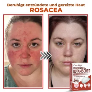 Oveallgo® MicroNeedle PLUS Botanical Day Clear Patch