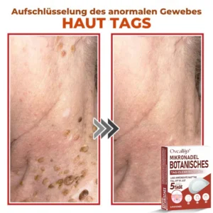 Oveallgo® MicroNeedle PLUS Botanical Day Clear Patch