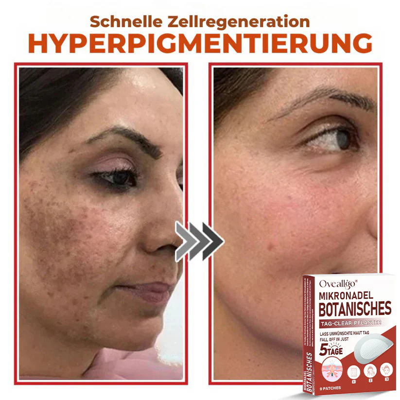 Oveallgo® MicroNeedle PLUS Botanical Day Clear Patch